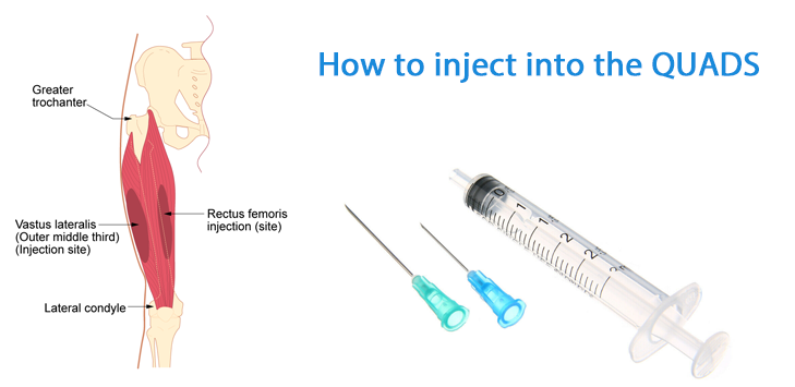 how-to-do-a-quad-injection