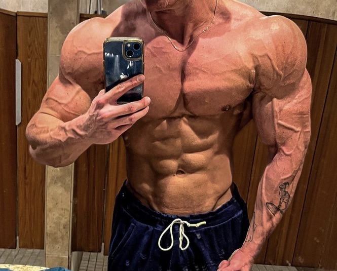 trestolone-acetate-ment-bodybuilding